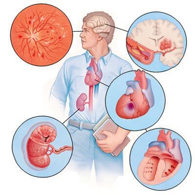 Cardiol apsaugo nuo gretutinių ligų išsivystymo